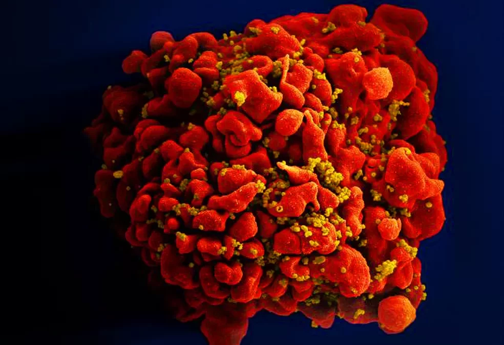 Remédio contra câncer pode ajudar a eliminar vírus HIV que fica latente nas células, aponta estudo