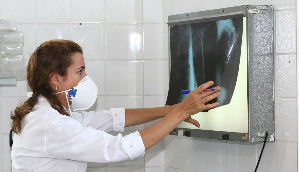 Brasil registra 78 mil novos casos de tuberculose