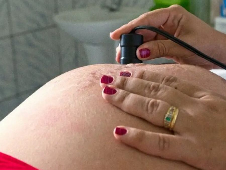 Especialistas alertam sobre riscos da baixa vacinação entre gestantes